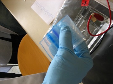 Human PARP(Poly ADP Ribose Polymerase) ELISA Kit